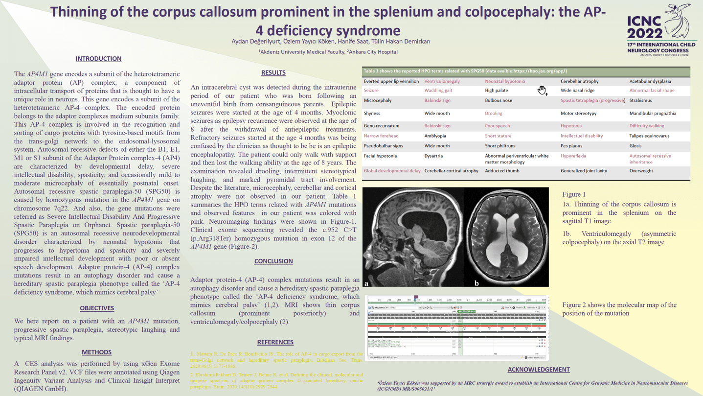 78 Thinning of the corpus callosum prominent in the splenium and colpocephaly: the AP-4 deficiency syndrome Aydan Değerliyurt, Özlem Yayıcı Köken, Hanife Saat, Tülin Hakan Demirkan