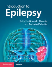 MSc Course in Epilepsy (Institute of Psychiatry, King&#039;s College London)