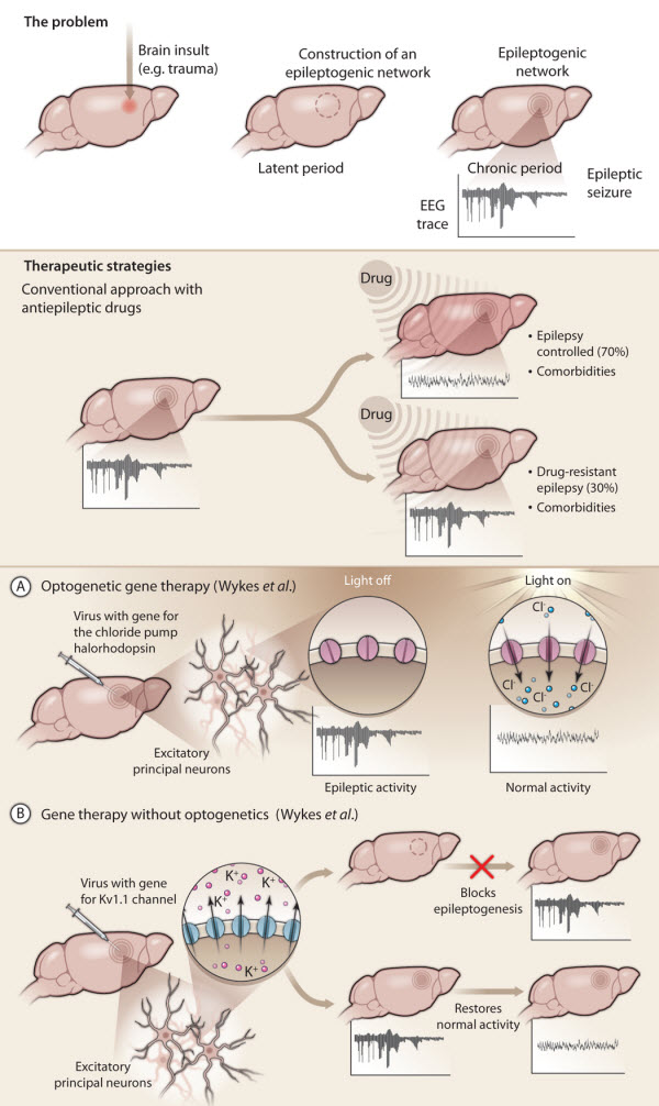 genetherapyforepilepsy-med